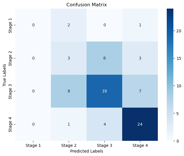 Model Comparison Results